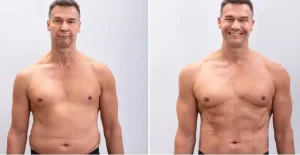 Testosterone-replacement-therapy-1